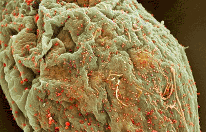 Image: Colored scanning electron micrograph (SEM) of HIV particles (red/orange) budding from the membrane of a host cell (photo courtesy Thomas Deerinck, NCMIR).